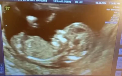 Échographie d&rsquo;une Grossesse Prise le 09.10.2024