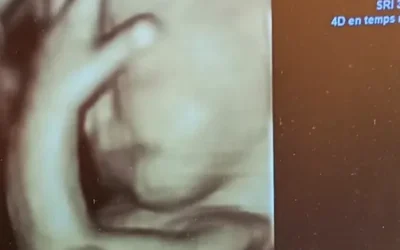 Échographie d&rsquo;une Grossesse Prise le 03.12.2025